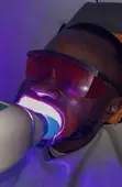 Teeth Whitening Service - 1