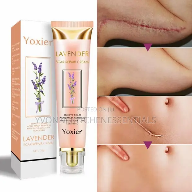 Yoxier Lavender Scar Removal Cream - 1