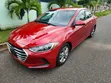 2017 Hyundai Elantra SE Sedan - 3