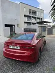 2017 Hyundai Elantra SE Sedan - 5