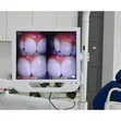Dental Intraoral Camera - 2