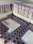 EDTA Vacuum Blood Collection Tubes - 1