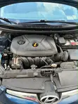 2016 Hyundai Elantra SE Sedan - Blue - 4