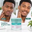 Saam Renewal Cream - Acne Remover & Skin Brightener - 2