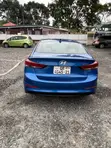 Hyundai Elantra 2017 Blue - 3